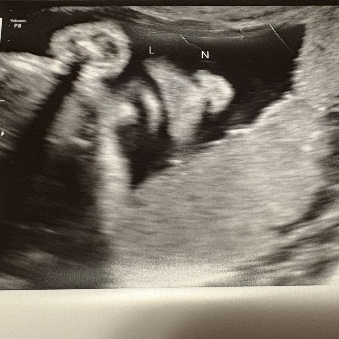 Photo shared by Emerald for their Babylist baby registry.