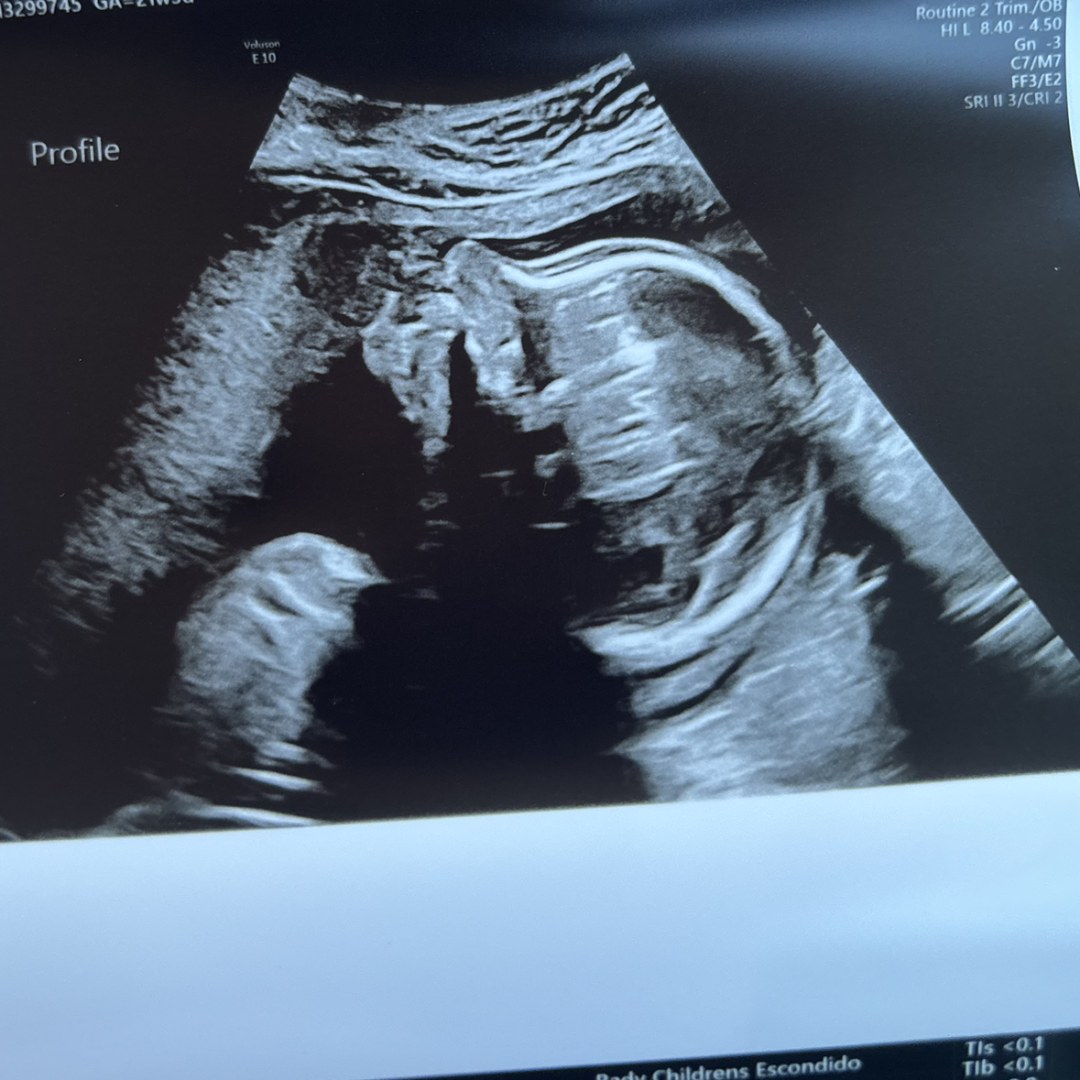 Photo shared by Lesley for their Babylist baby registry.