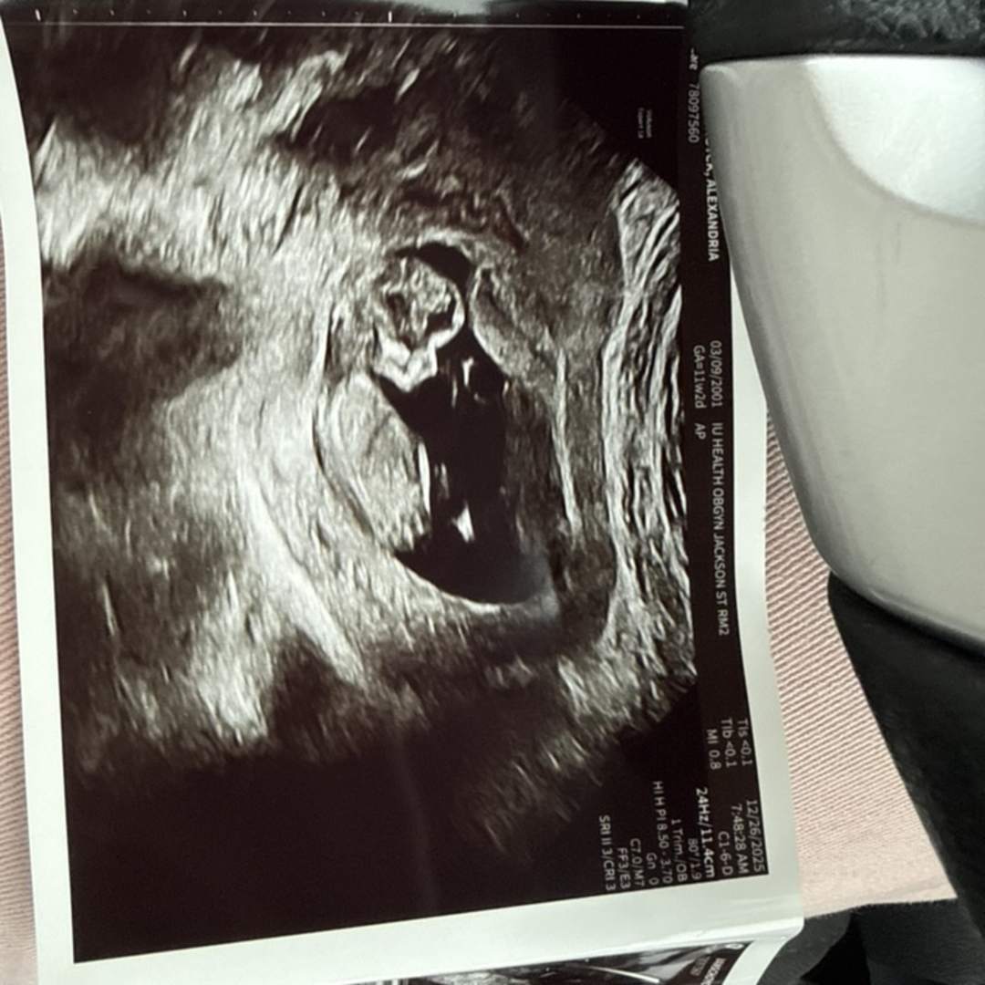 Photo shared by Alexandria for their Babylist baby registry.