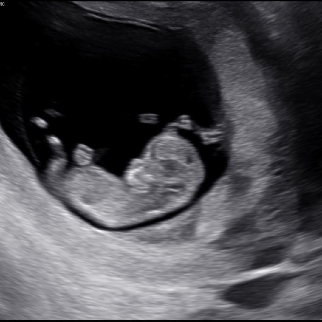 Photo shared by Nadia for their Babylist baby registry.