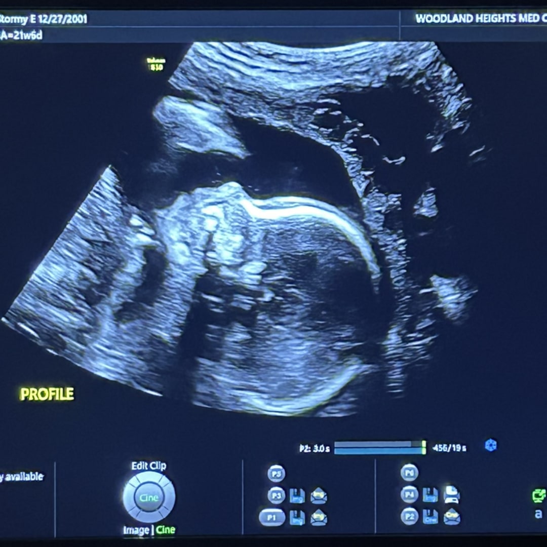 Photo shared by Stormy for their Babylist baby registry.