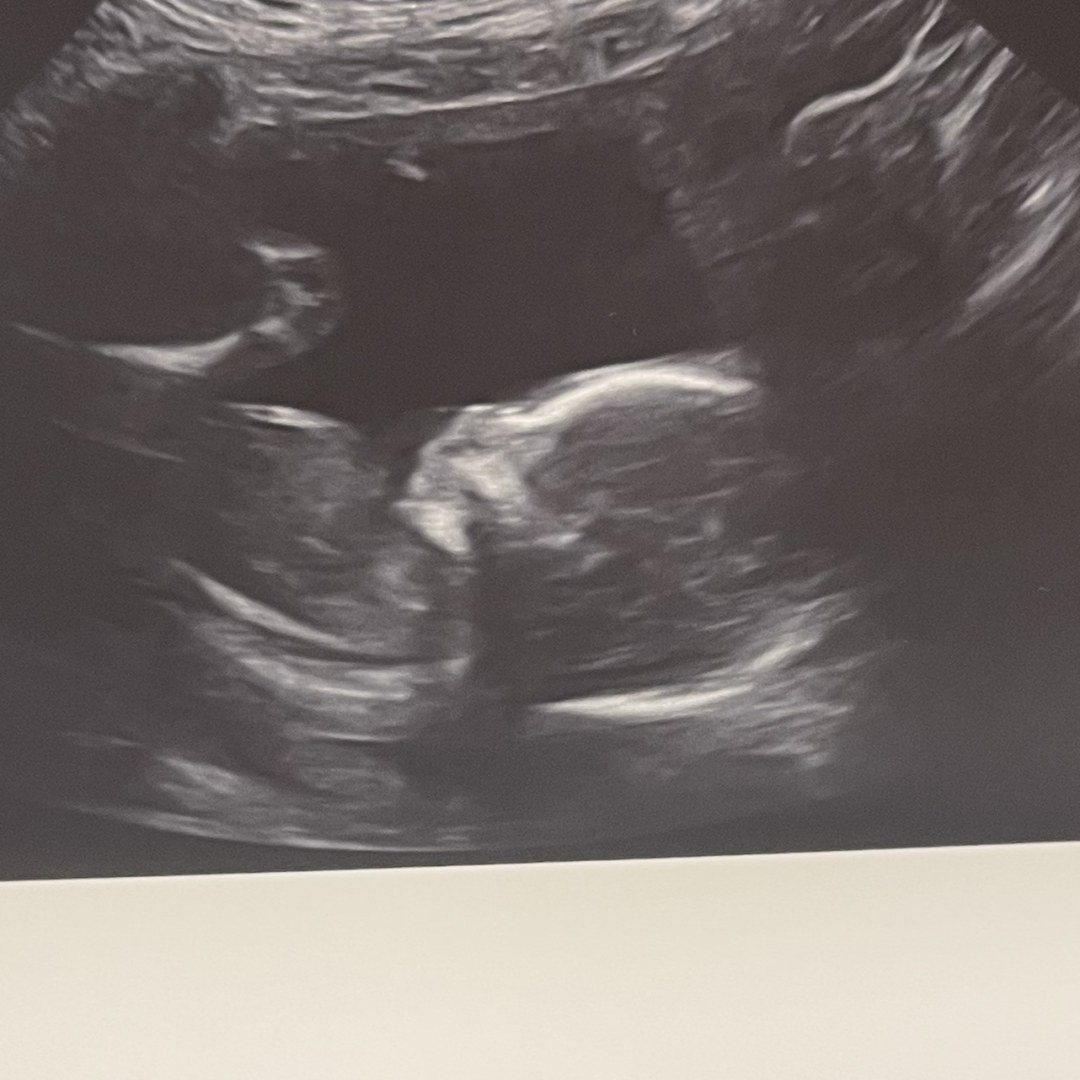 Photo shared by Abbey for their Babylist baby registry.