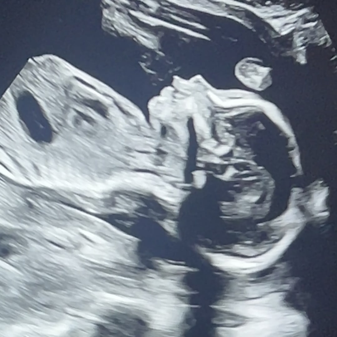 Photo shared by Stephanie for their Babylist baby registry.