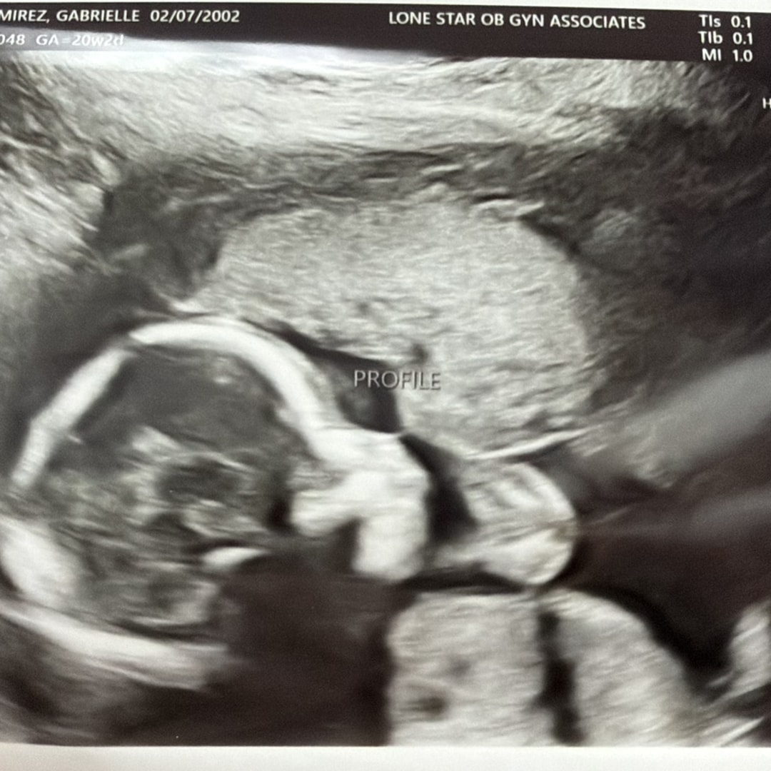 Photo shared by Gabrielle for their Babylist baby registry.
