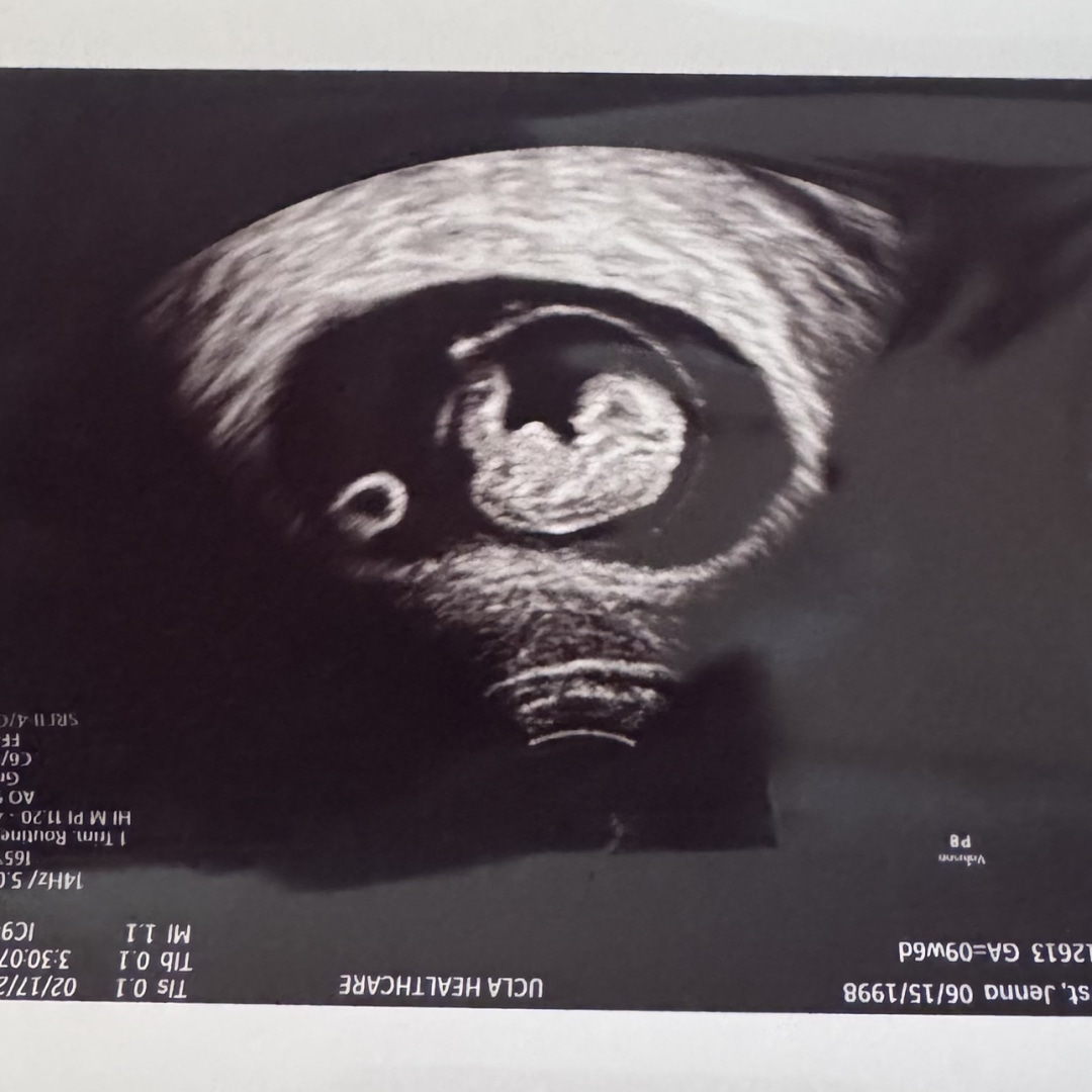 Photo shared by Jenna for their Babylist baby registry.