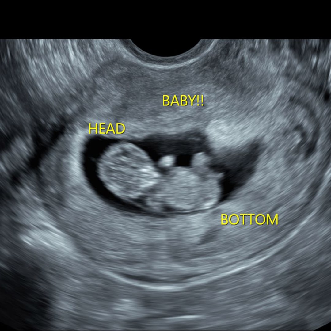 Photo shared by Pedro for their Babylist baby registry.