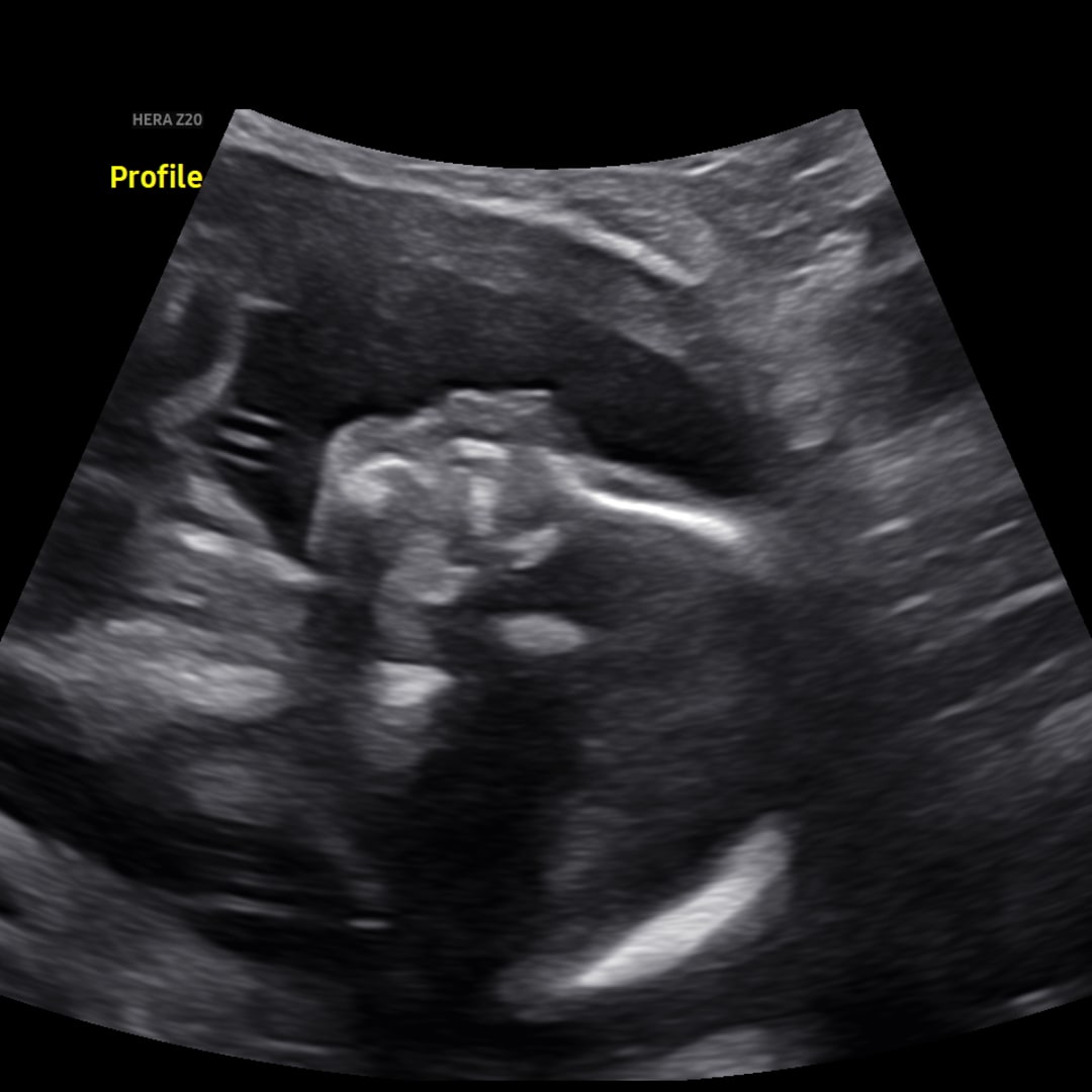 Photo shared by Gabriella for their Babylist baby registry.