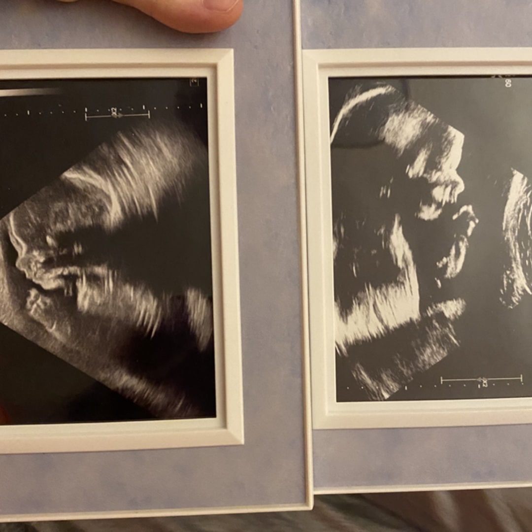 Photo shared by Skylar for their Babylist baby registry.