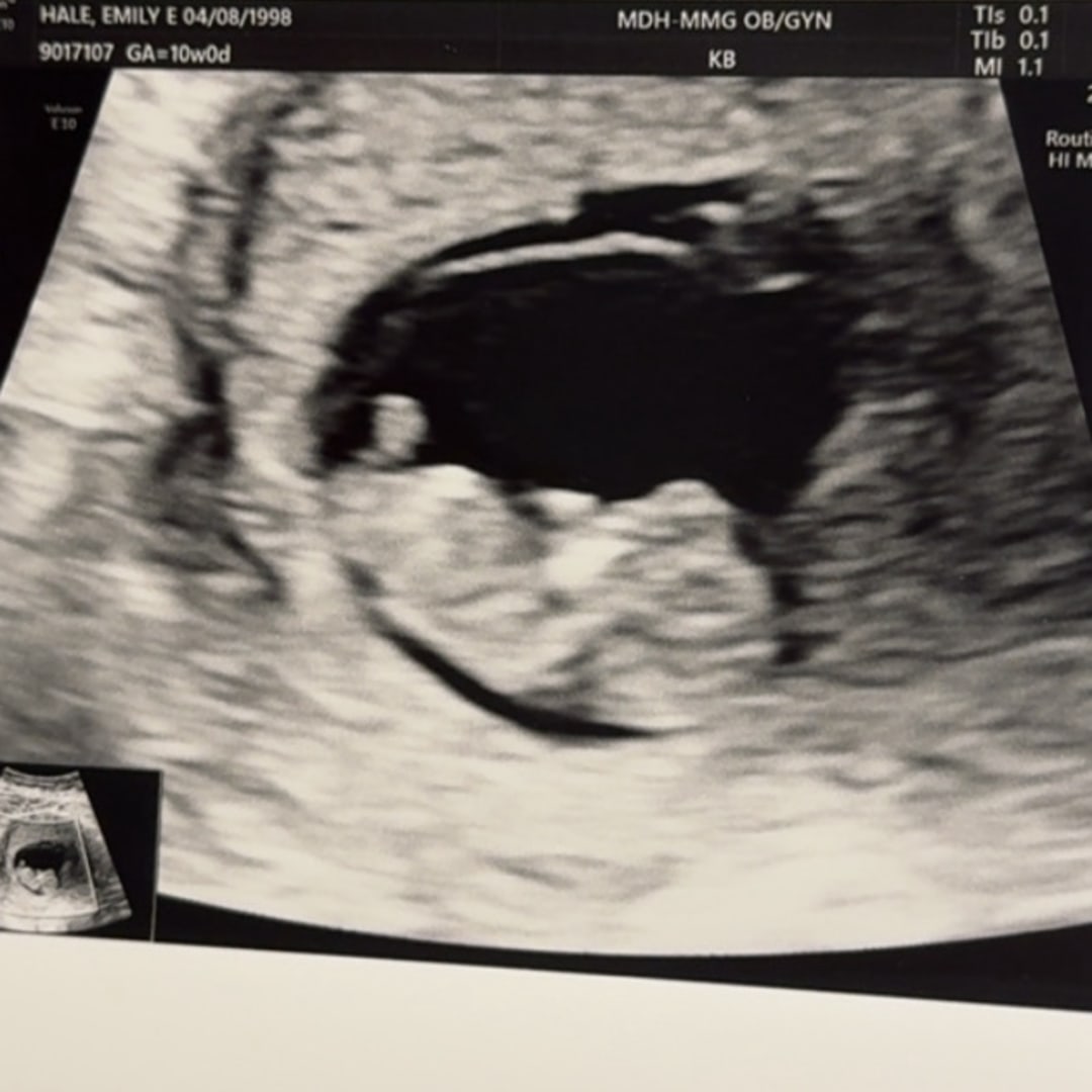 Photo shared by Emily for their Babylist baby registry.