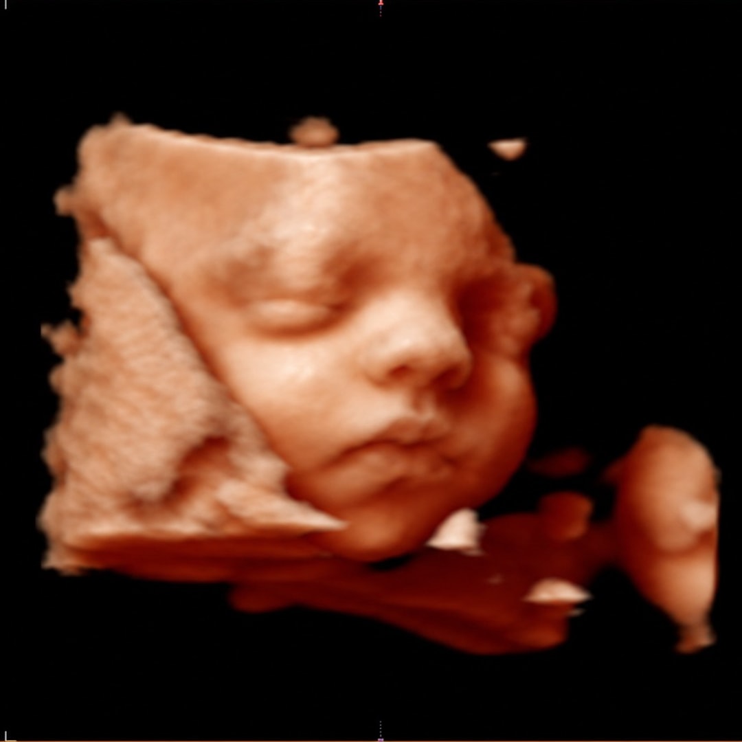 Photo shared by Emma for their Babylist baby registry.
