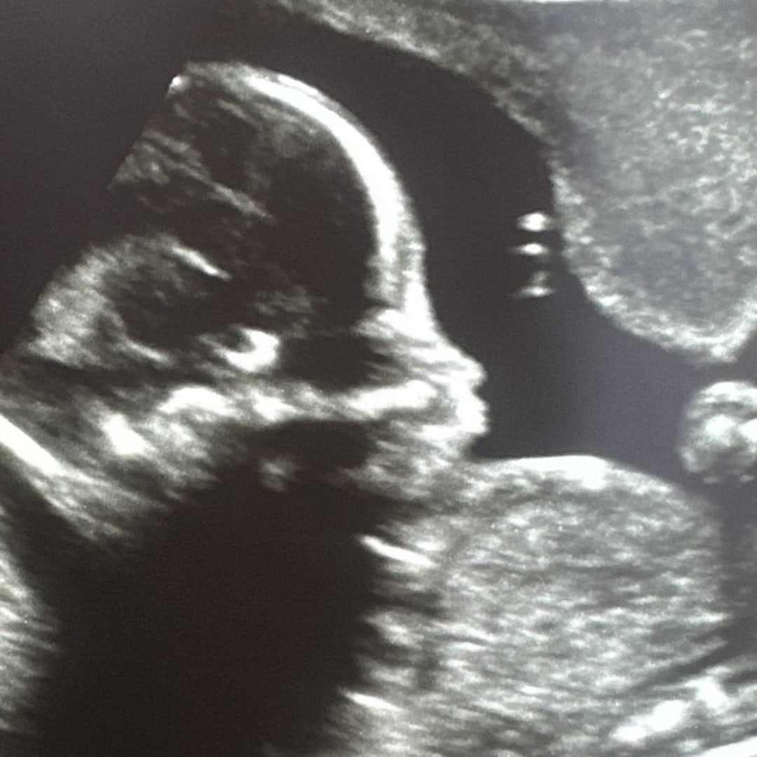 Photo shared by Elijah for their Babylist baby registry.