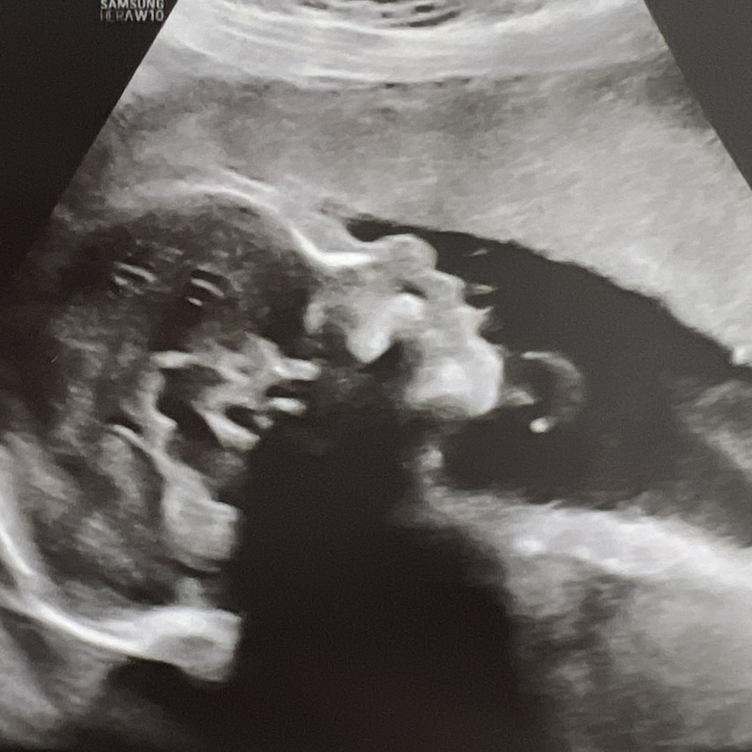 Photo shared by Tanya for their Babylist baby registry.