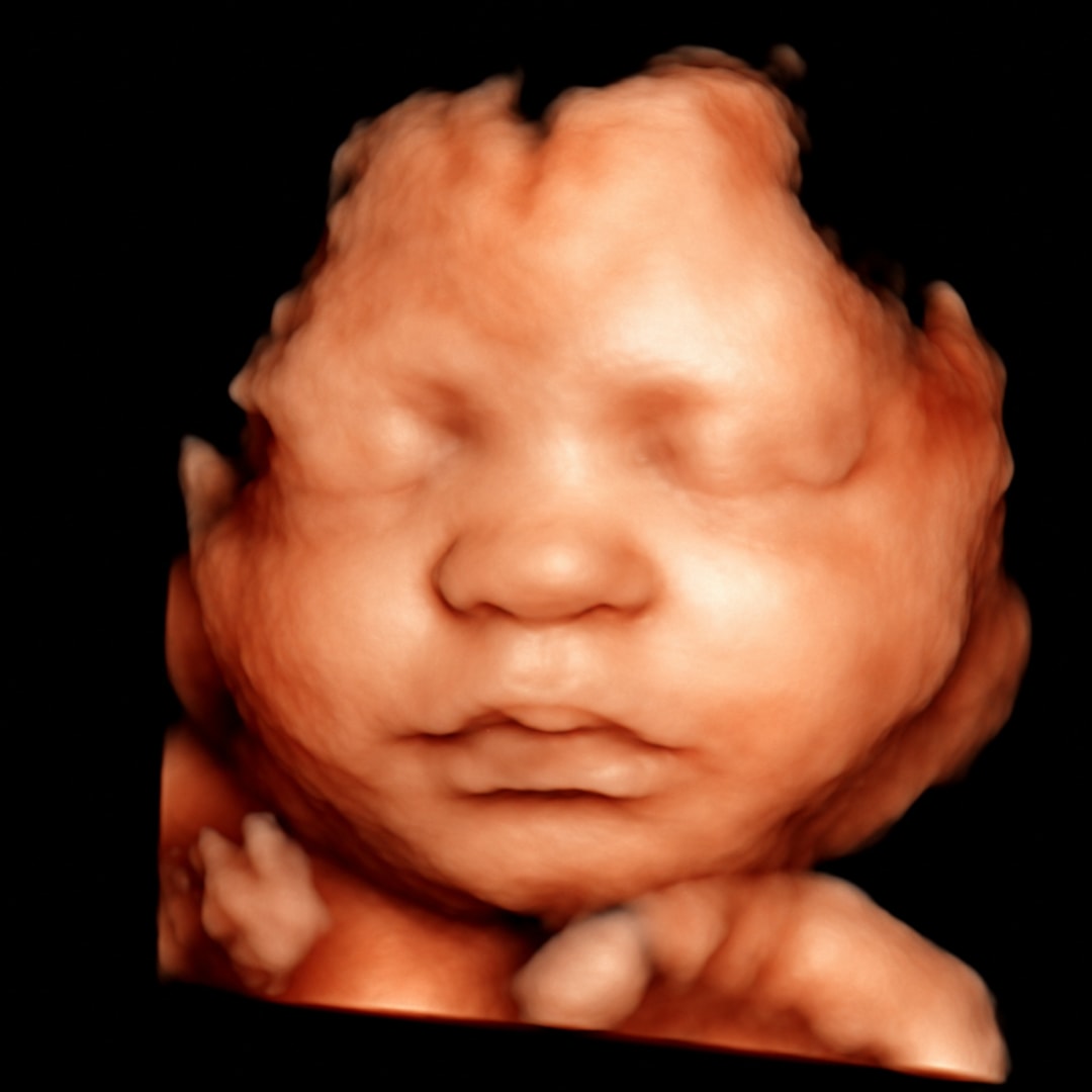 Photo shared by Mira for their Babylist baby registry.