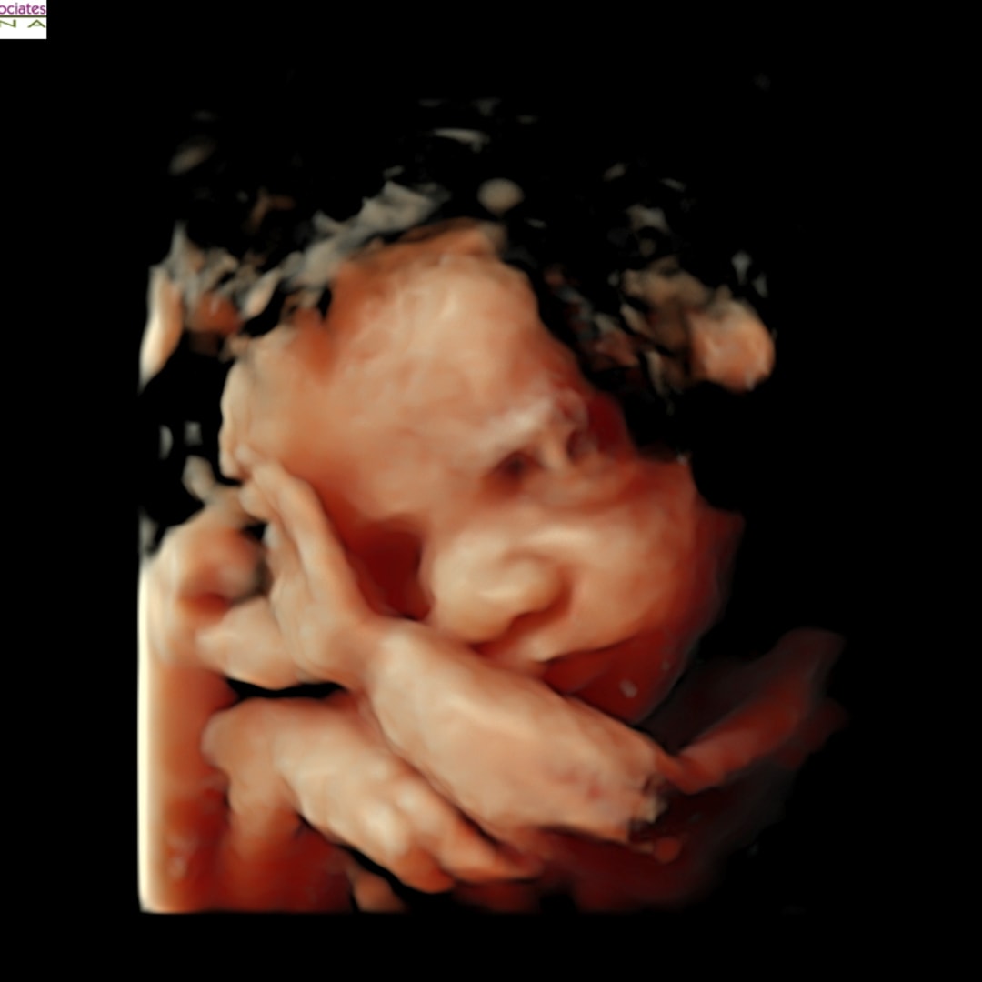 Photo shared by Carmen for their Babylist baby registry.