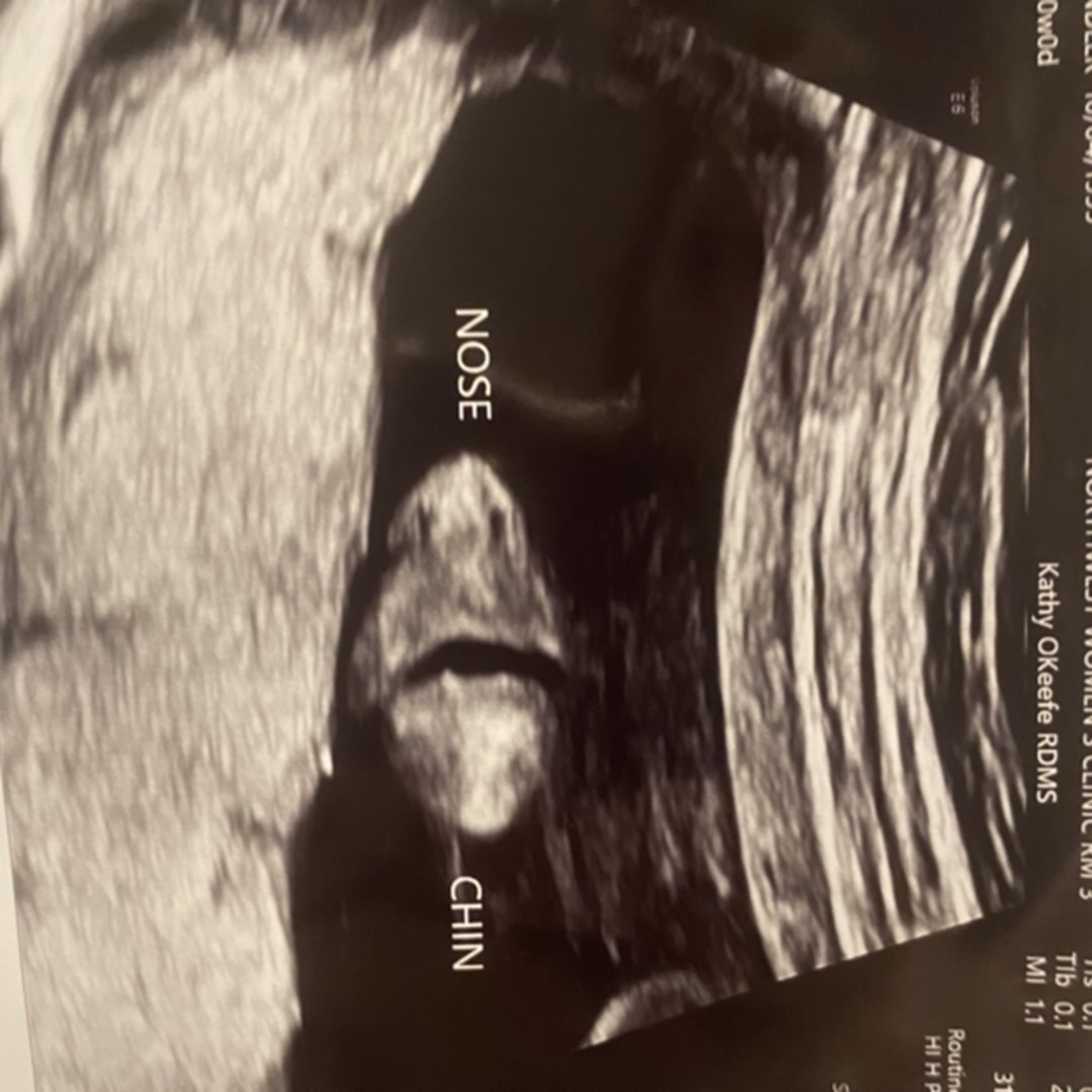 Photo shared by Chandler for their Babylist baby registry.