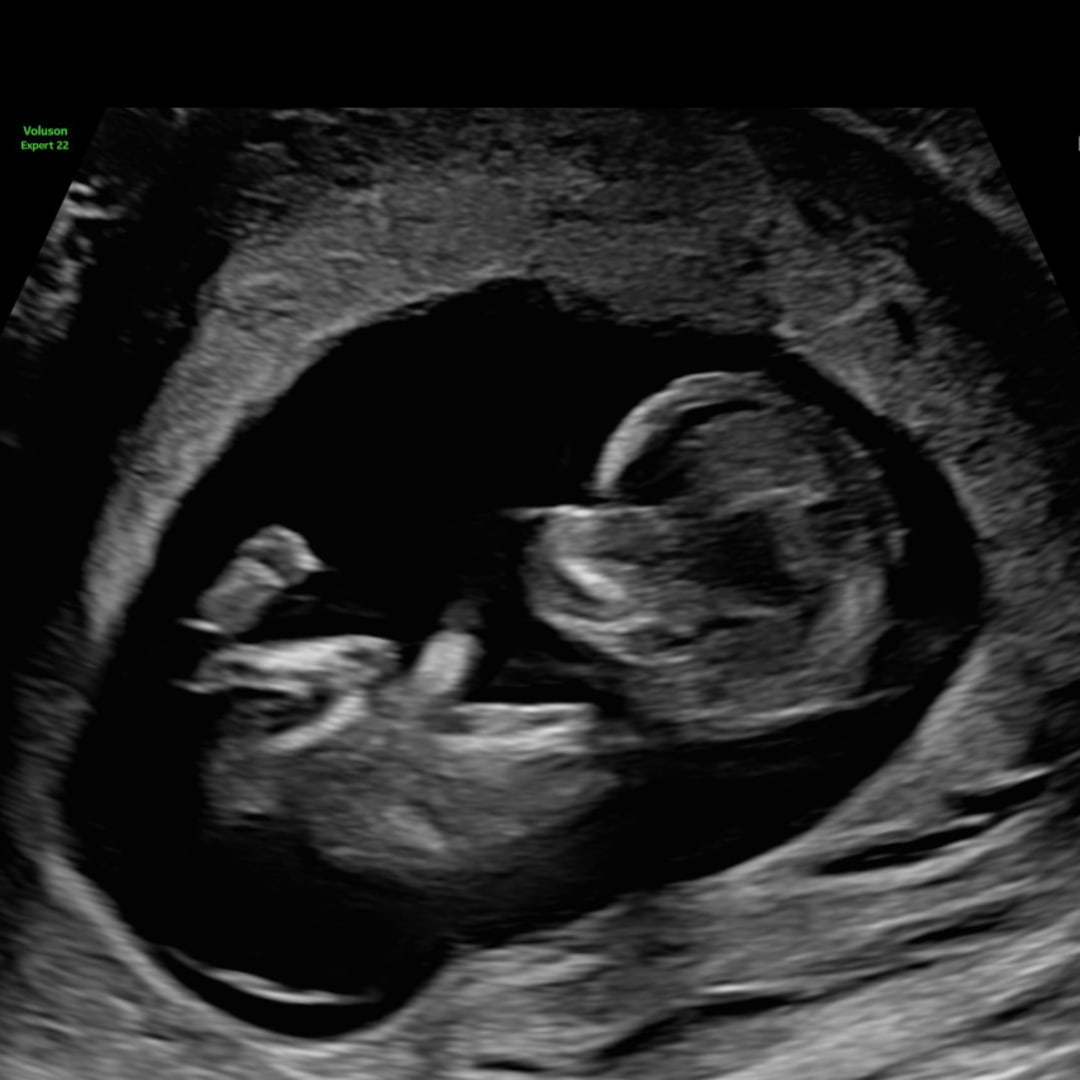 Photo shared by Amara for their Babylist baby registry.