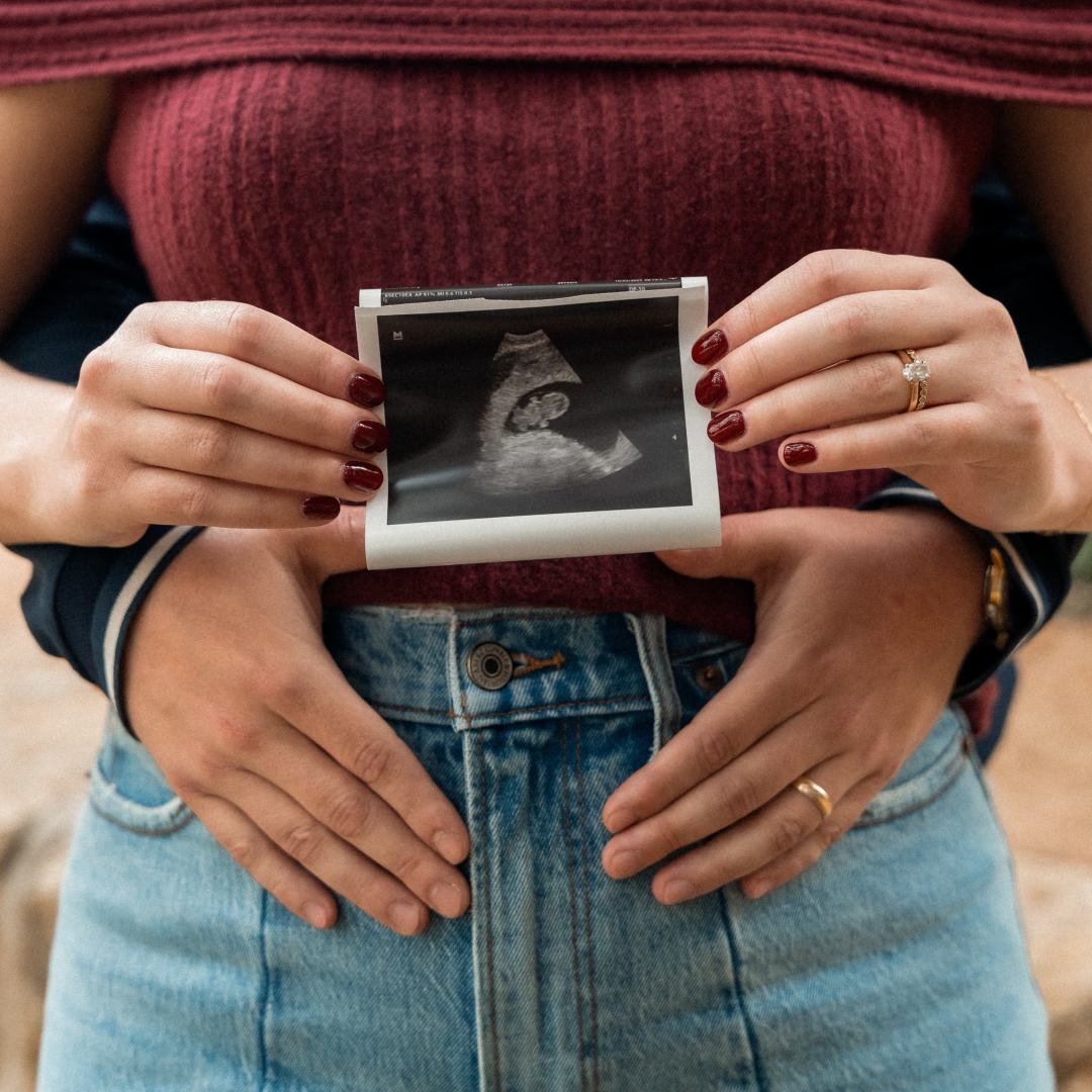 Photo shared by Morgan & Alfonso for their Babylist baby registry.