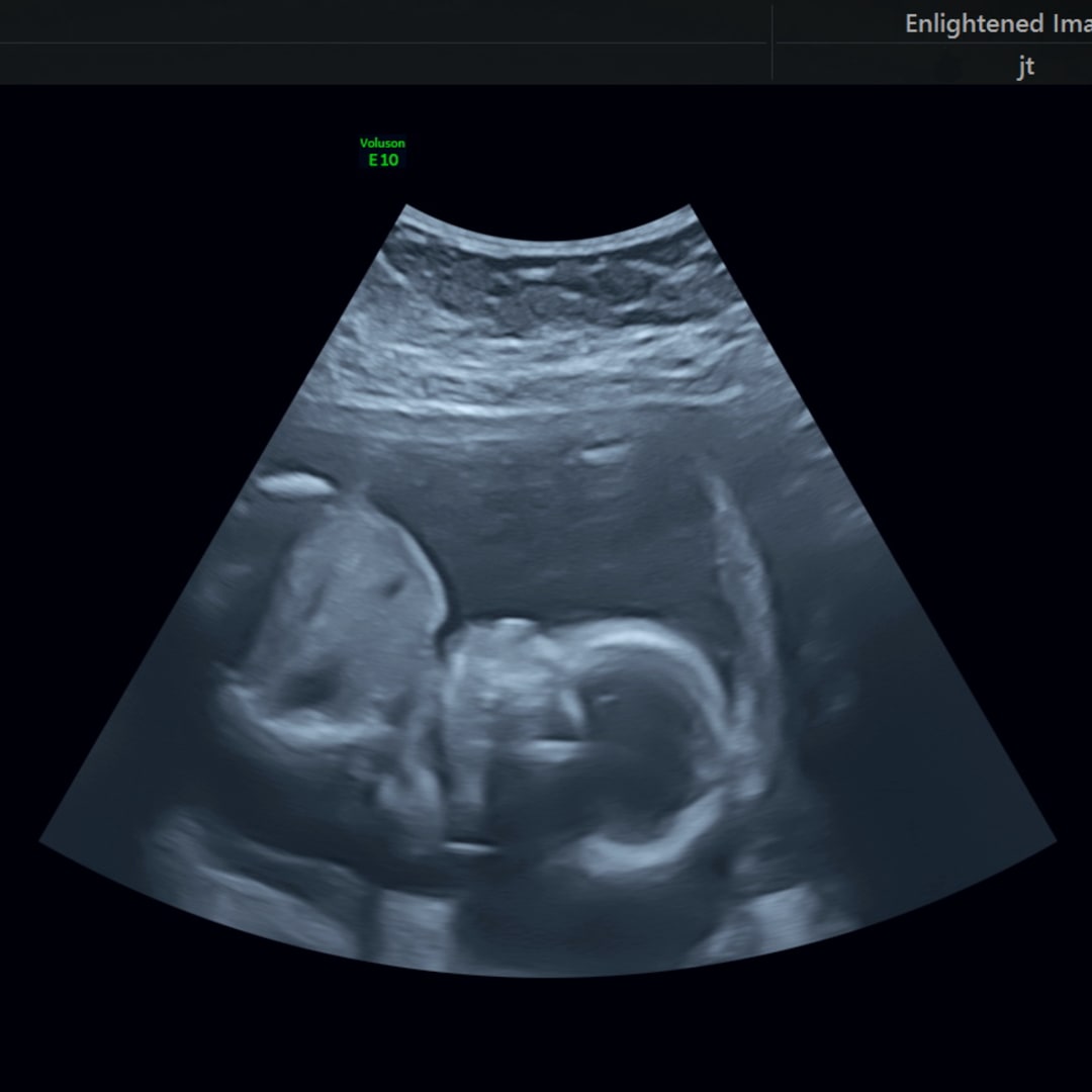 Photo shared by Ella for their Babylist baby registry.
