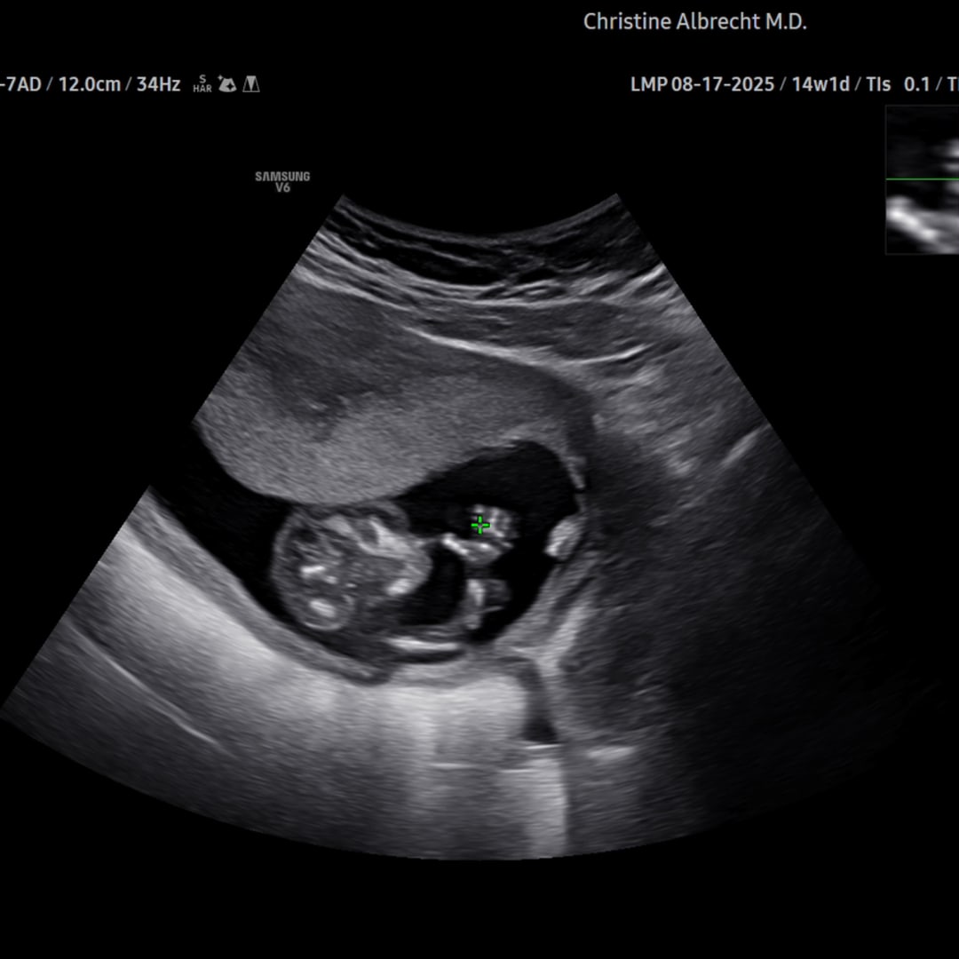 Photo shared by Jailyn for their Babylist baby registry.