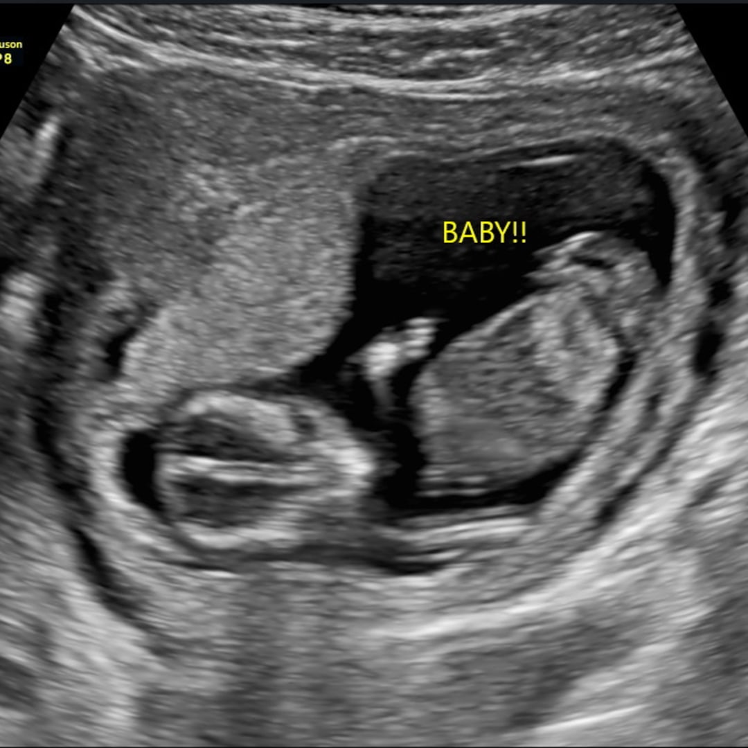 Photo shared by Mandy for their Babylist baby registry.