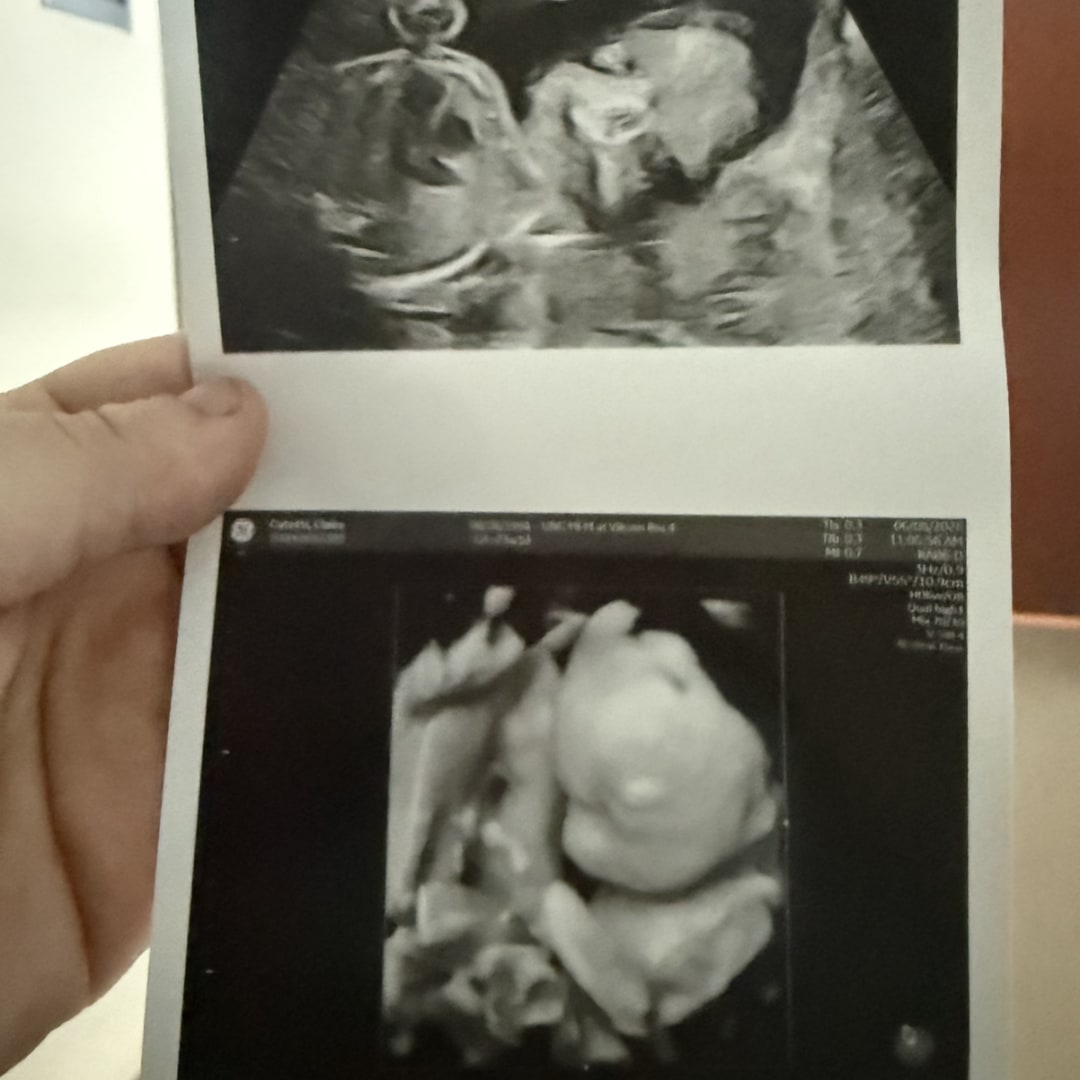 Photo shared by Claire for their Babylist baby registry.