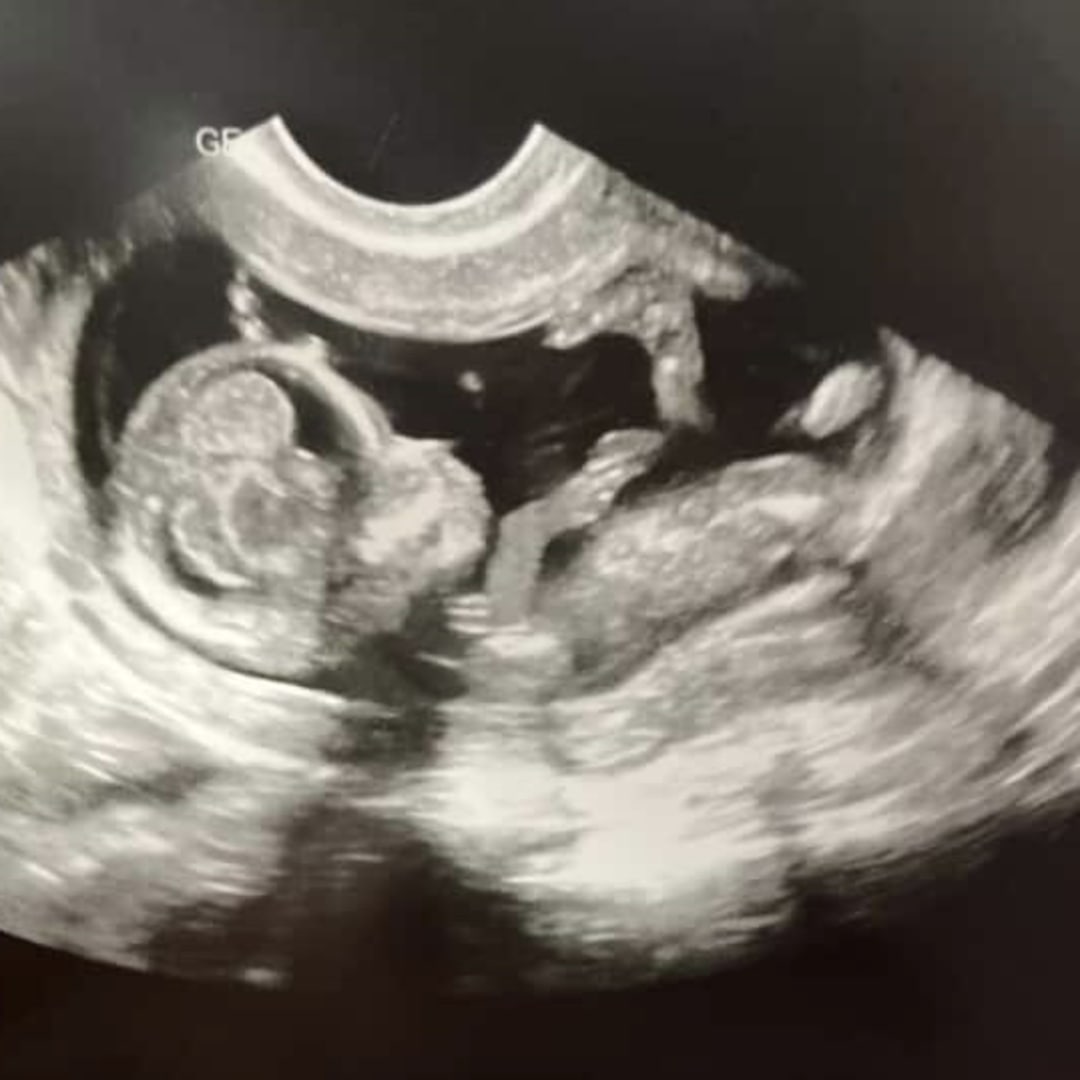 Photo shared by Jessica for their Babylist baby registry.