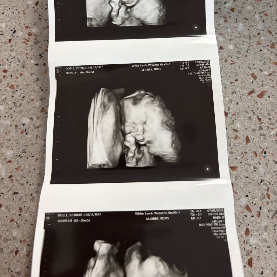 Photo shared by Stormie for their Babylist baby registry.