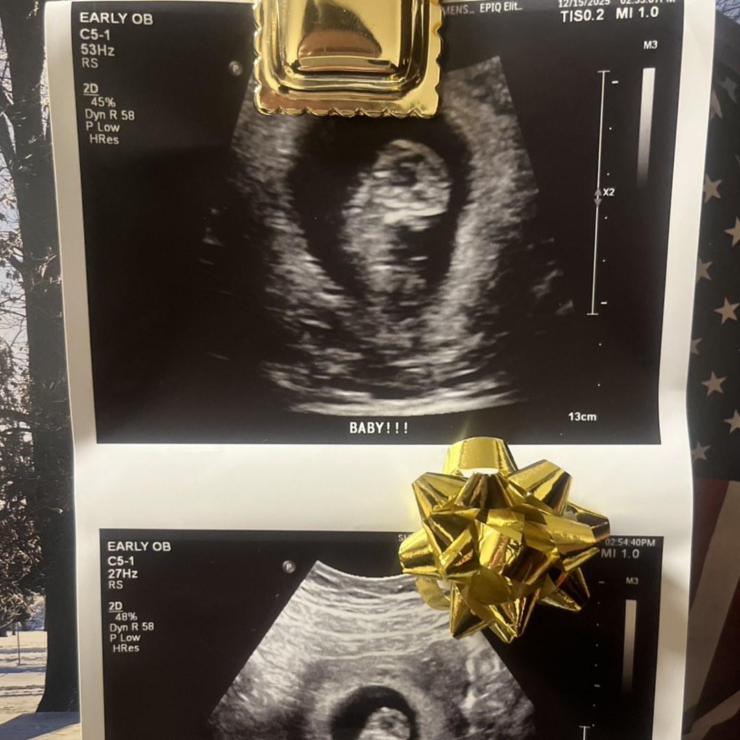 Photo shared by Adia for their Babylist baby registry.