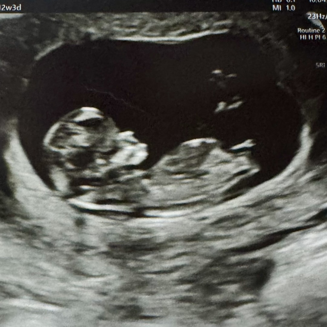 Photo shared by Emily for their Babylist baby registry.
