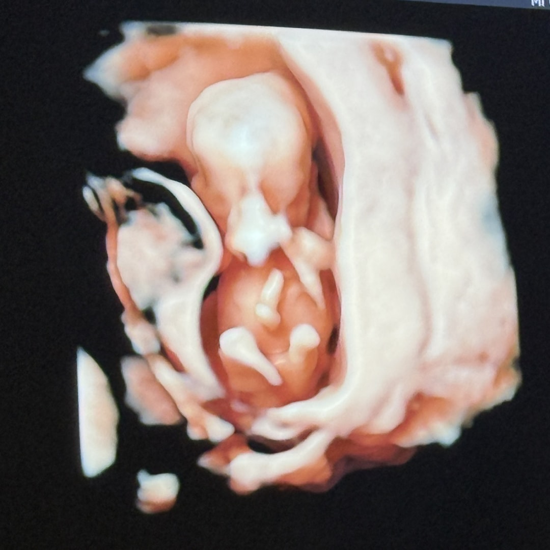 Photo shared by Sergio for their Babylist baby registry.