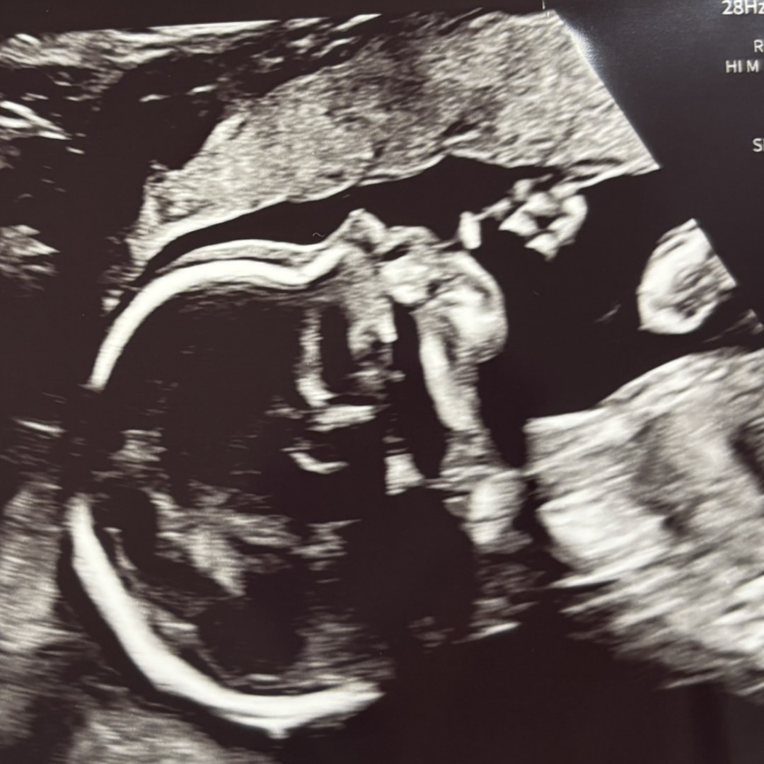 Photo shared by Olivia for their Babylist baby registry.