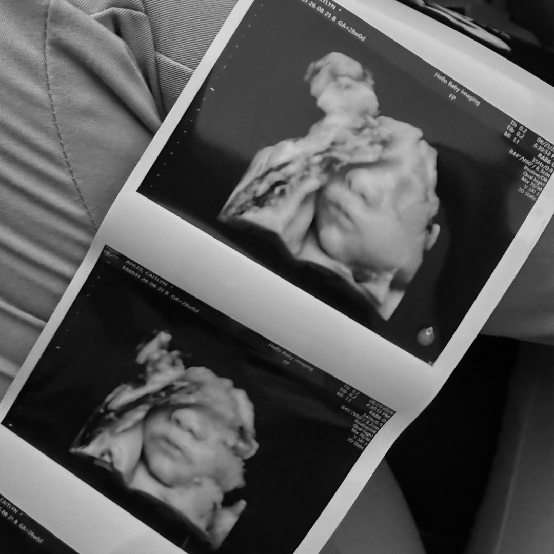 Photo shared by Caitlyn for their Babylist baby registry.