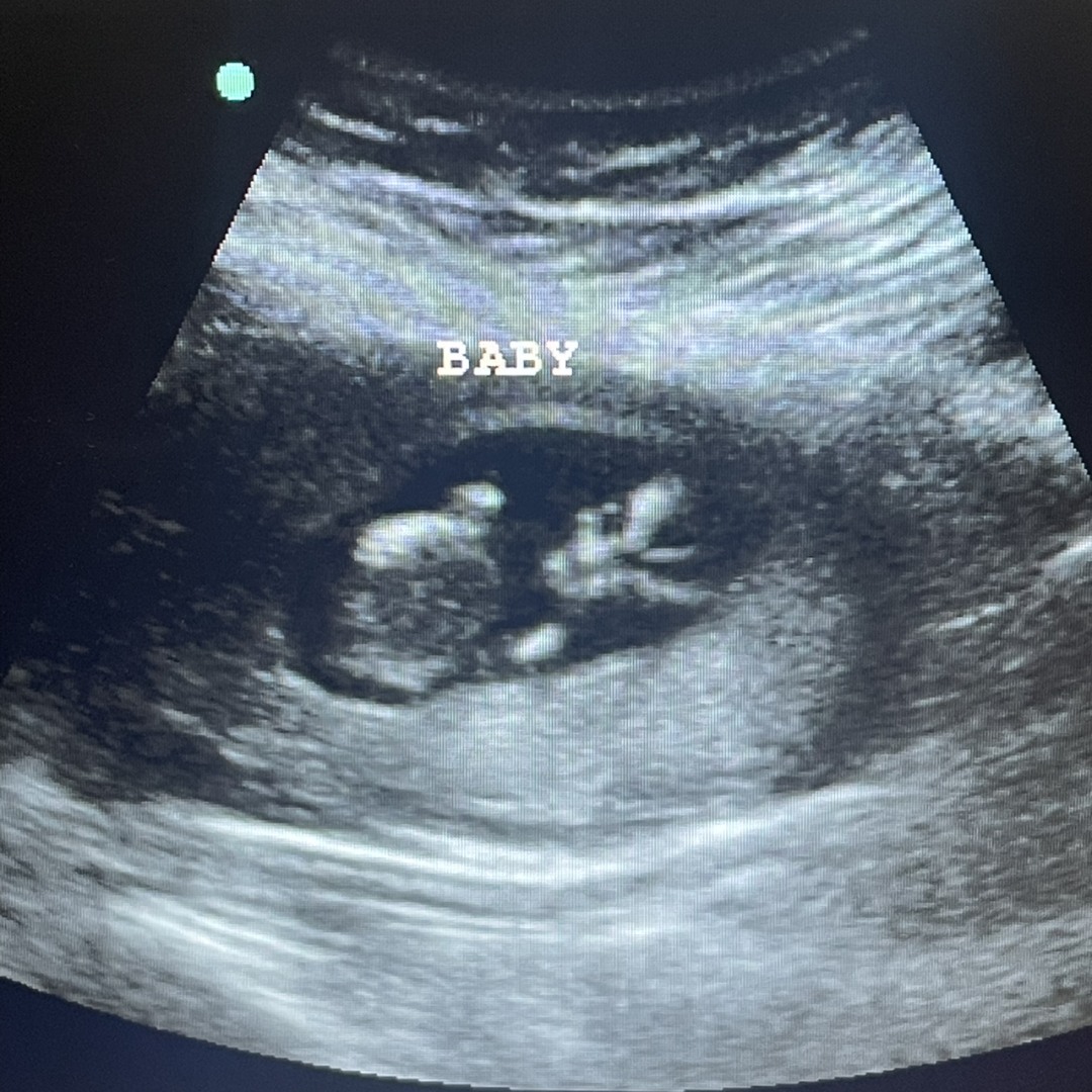 Photo shared by Mayra for their Babylist baby registry.