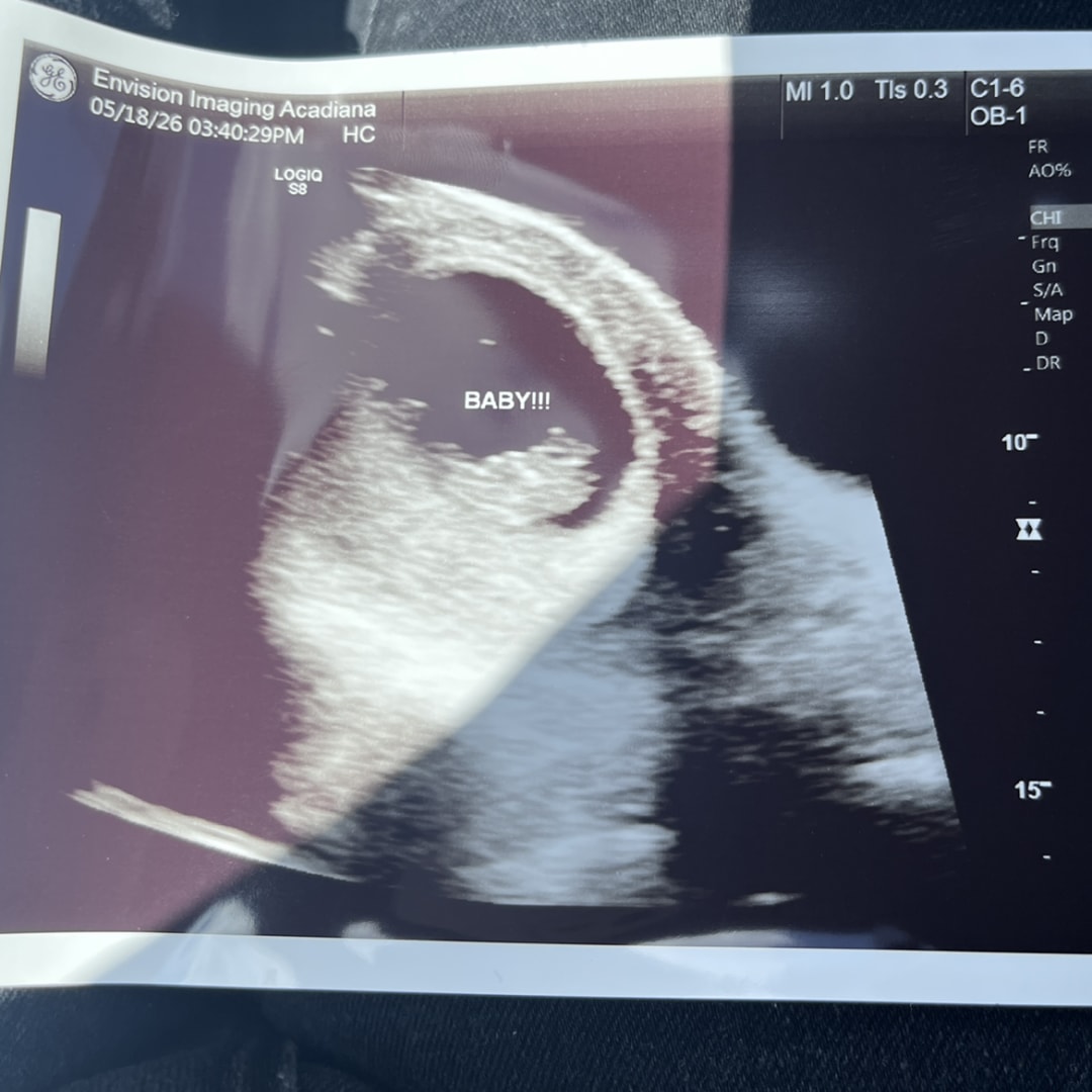 Photo shared by Jasmine for their Babylist baby registry.