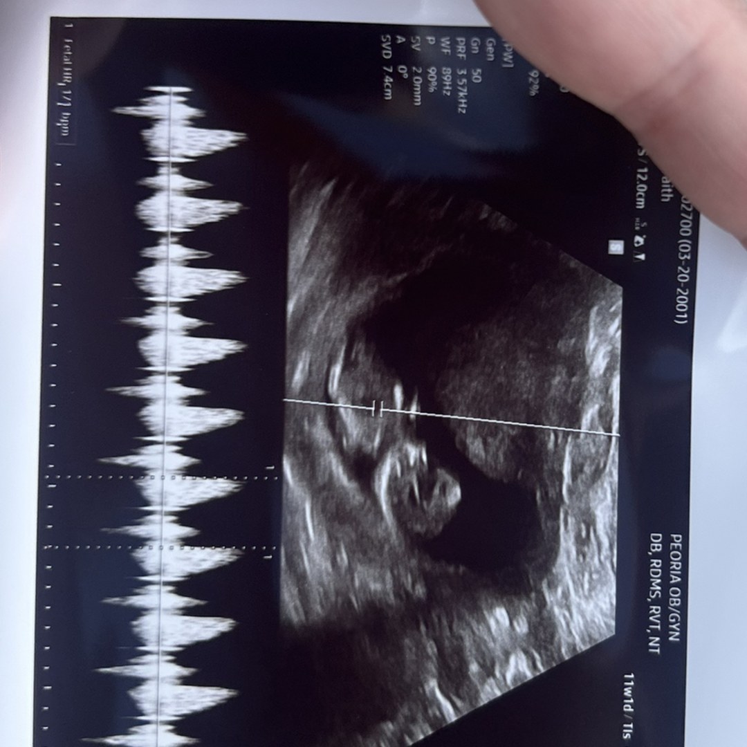 Photo shared by Faith for their Babylist baby registry.