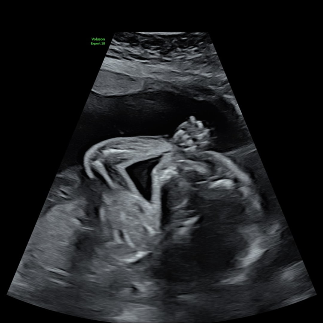 Photo shared by Guadalupe for their Babylist baby registry.