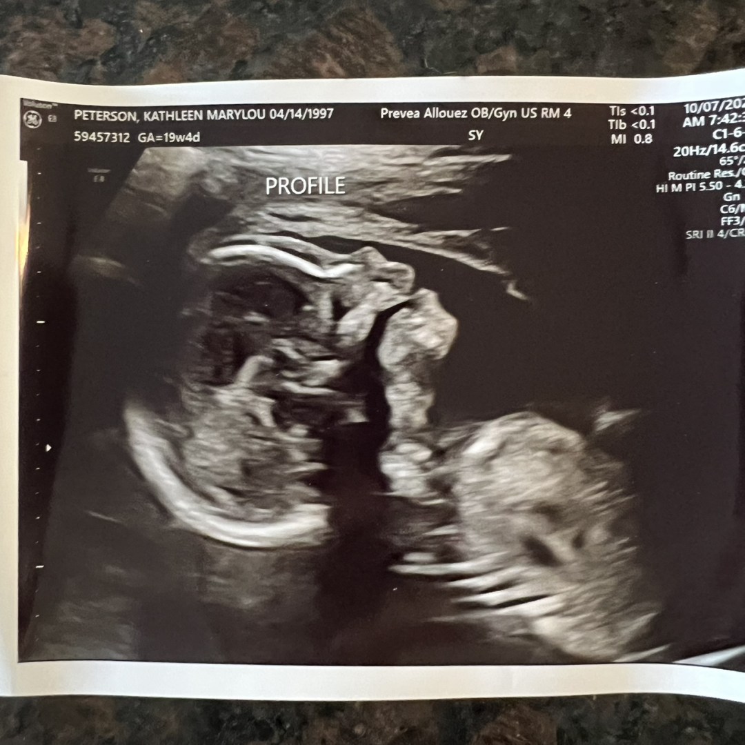 Photo shared by Katie for their Babylist baby registry.