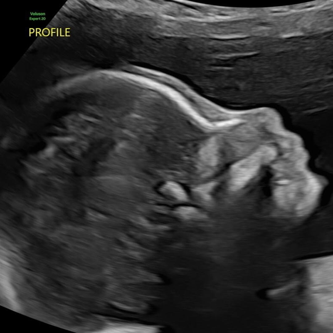 Photo shared by Rosetta for their Babylist baby registry.