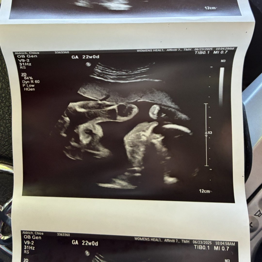 Photo shared by Chloe for their Babylist baby registry.