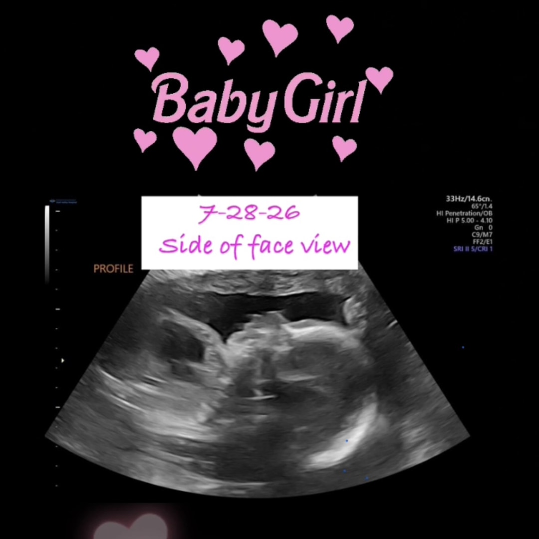 Photo shared by Ashley for their Babylist baby registry.