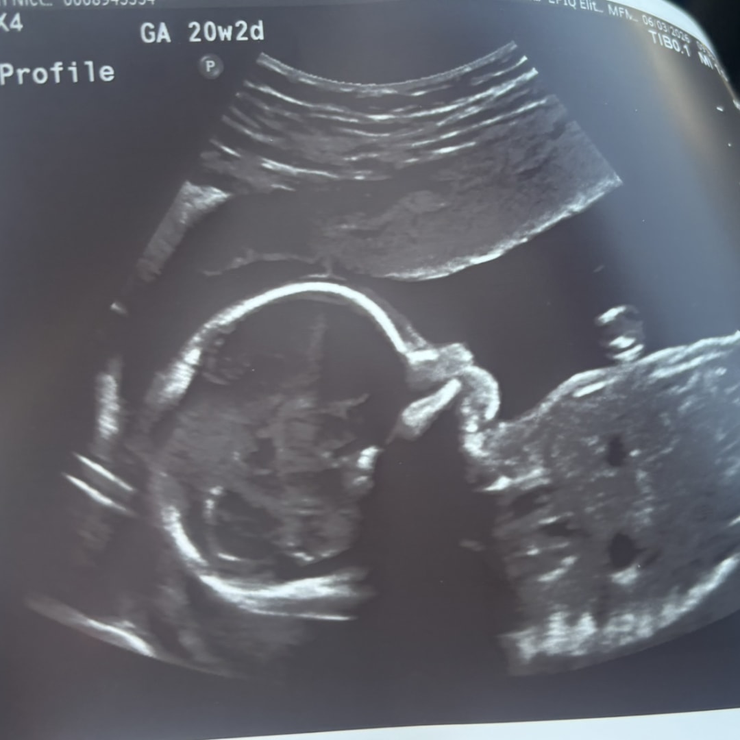 Photo shared by Megan for their Babylist baby registry.
