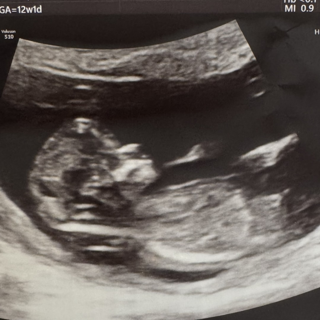 Photo shared by Kate for their Babylist baby registry.