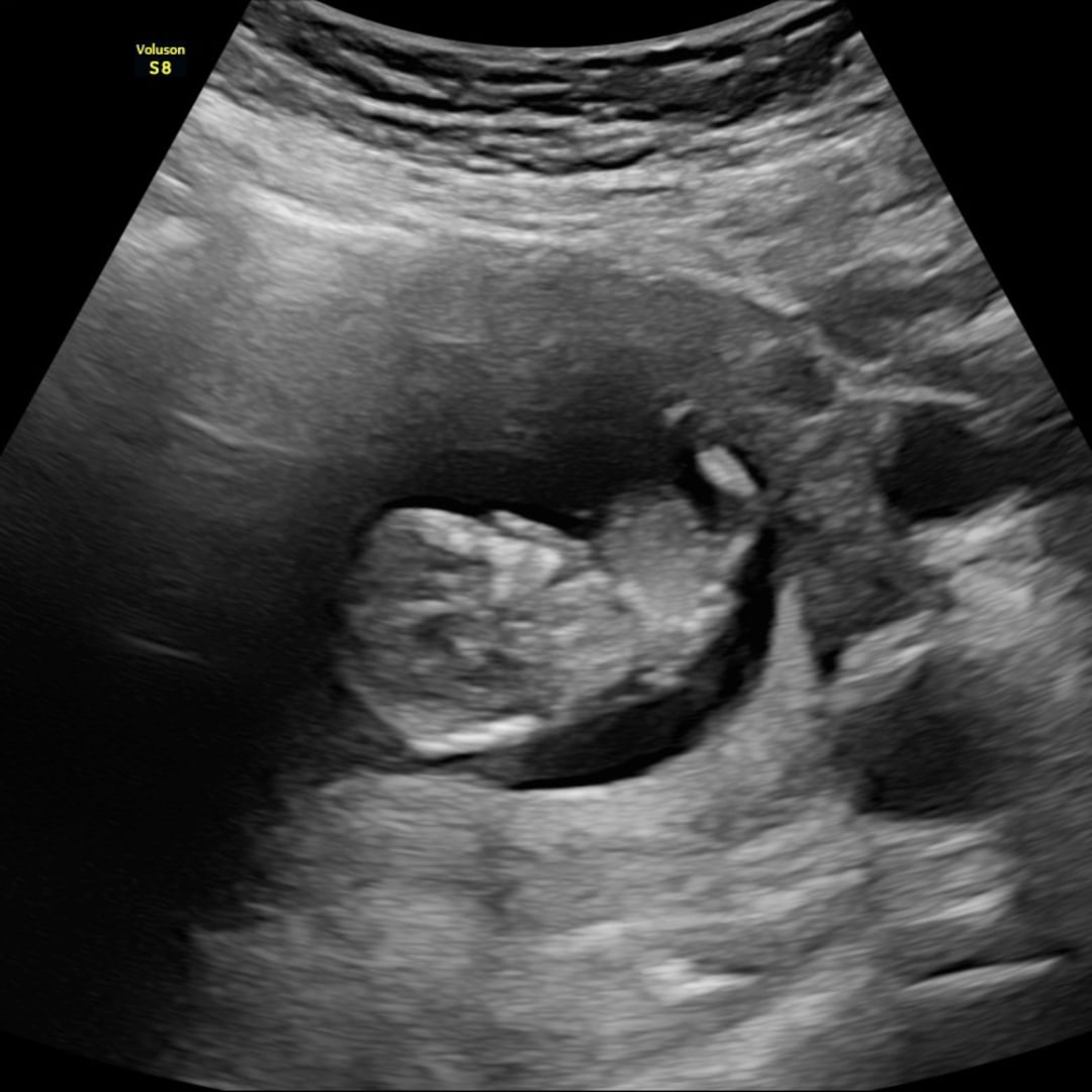 Photo shared by Aubrey for their Babylist baby registry.