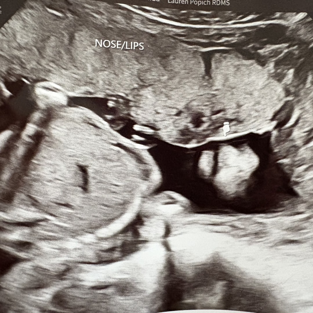 Photo shared by Tahmya for their Babylist baby registry.