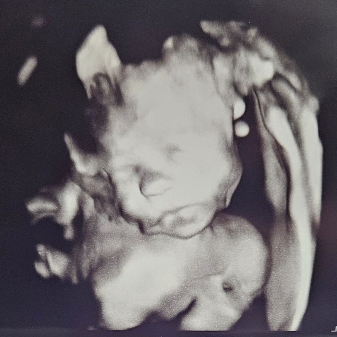 Photo shared by Megan for their Babylist baby registry.