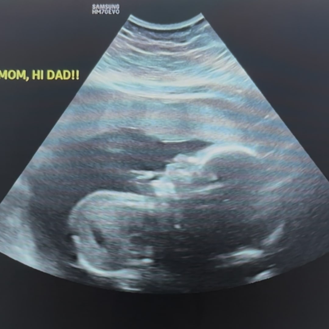 Photo shared by Britney for their Babylist baby registry.