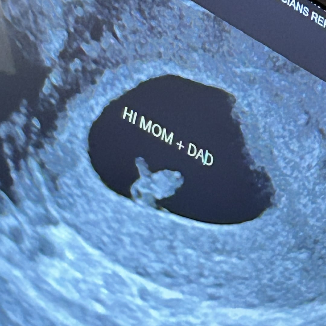 Photo shared by Emily for their Babylist baby registry.