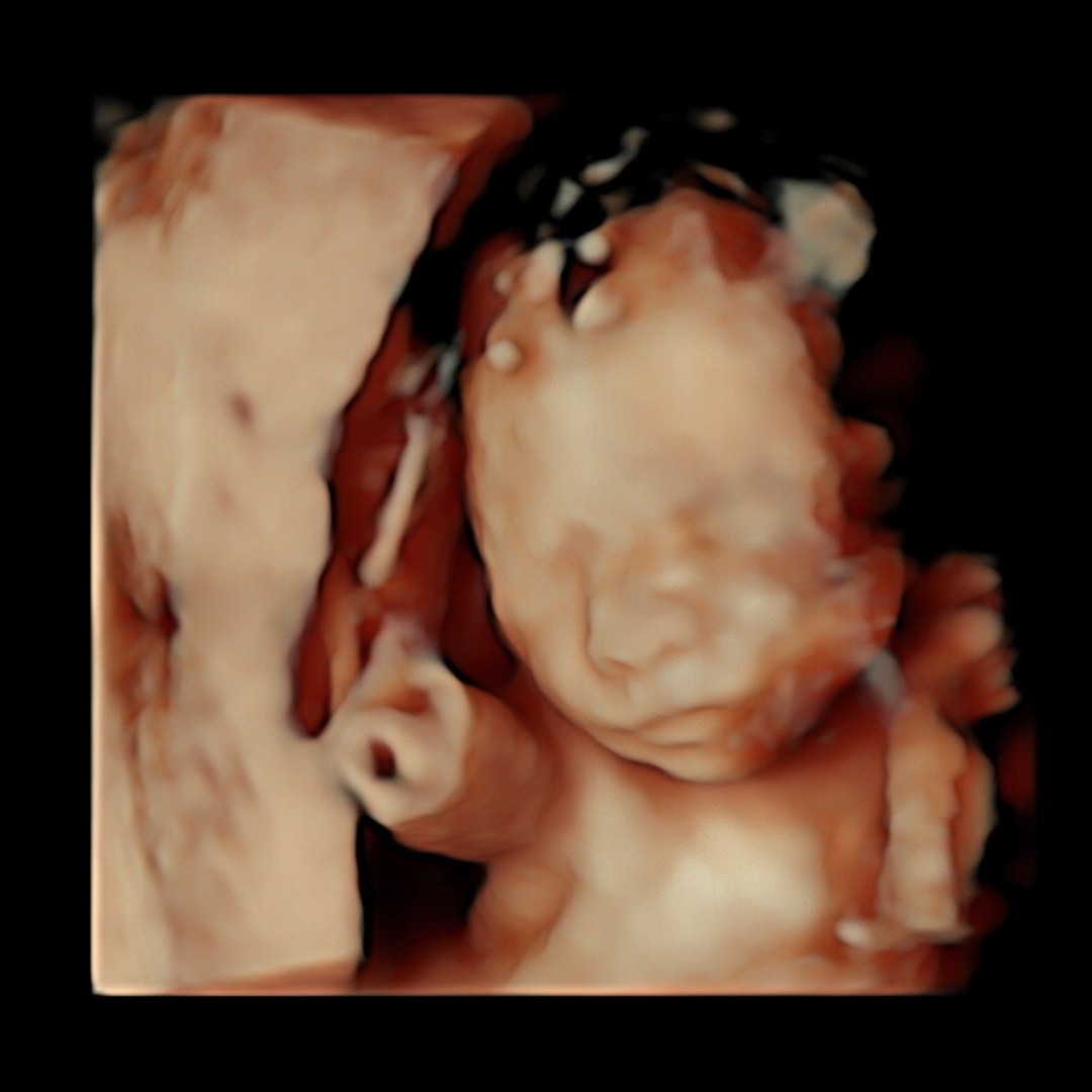 Photo shared by Jayme for their Babylist baby registry.