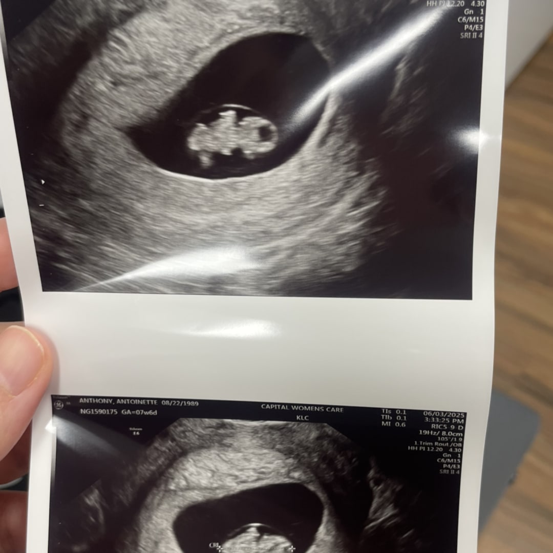 Photo shared by Antoinette for their Babylist baby registry.
