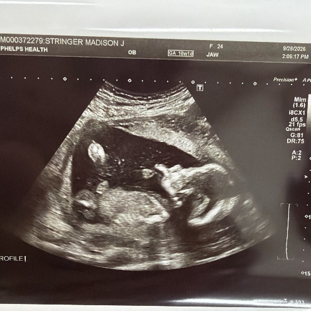 Photo shared by Madison for their Babylist baby registry.